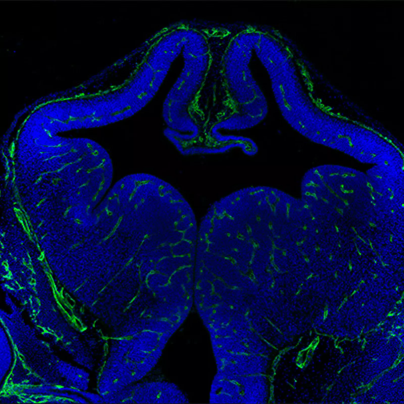 Blood Brain Barrier Development